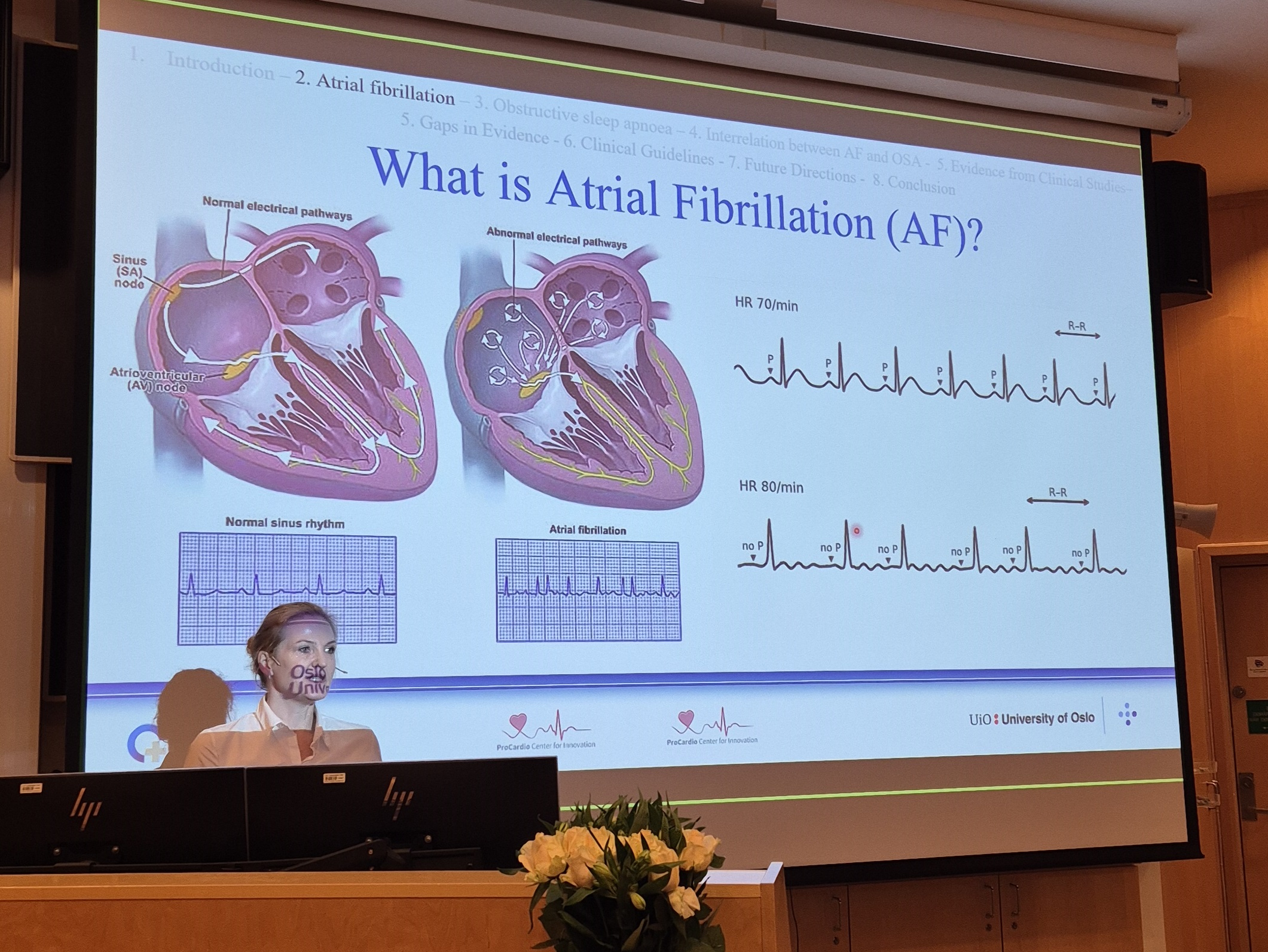 A screen with a picture on it