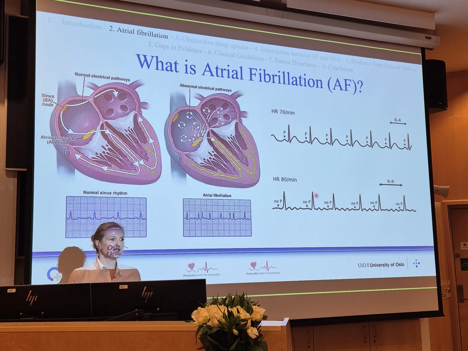 A screen with a picture on it