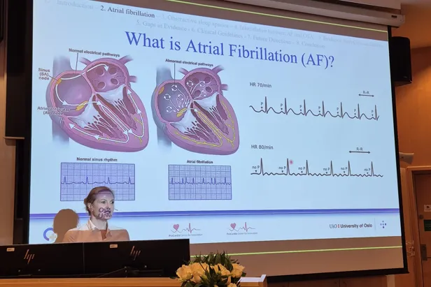 A screen with a picture on it