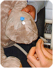 Sykehusmaskoten Rasmus får CVK