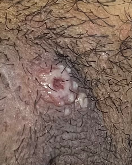 Et nærbilde av et hull i et tre