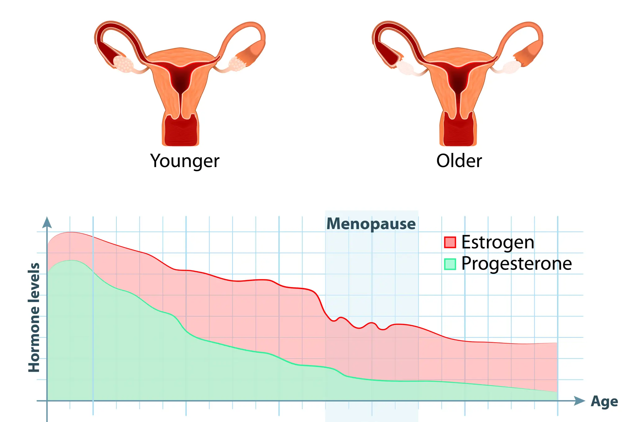 Figur som viser gradvis nedgang av østrogen og progrestron over tid, med et større fall, og større variasjon, under overgangsalder