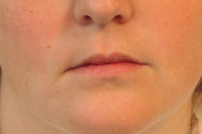 Et nærbilde av en persons ansikt